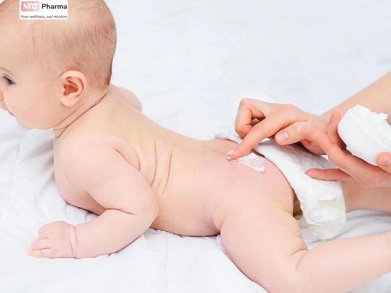 Ba mẹ bôi kem dưỡng chăm sóc vùng da bị hăm tã